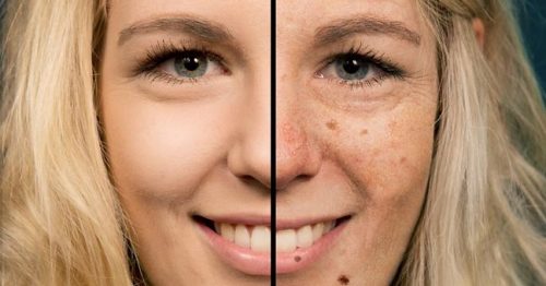 App mostra como seu rosto pode ficar se você não usar protetor solar; confira!